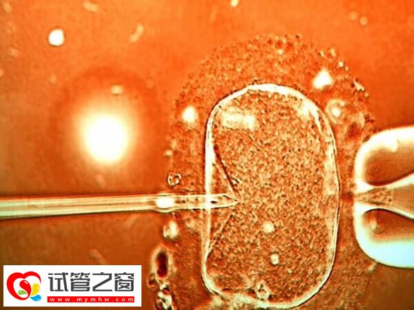 試管嬰兒成功率與什么有關(guān)