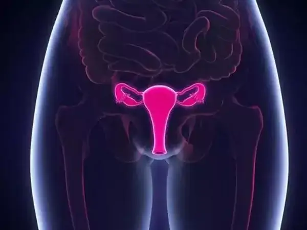 會引起不孕的子宮疾病有哪些(圖1) 子宮畸形則是指子宮形態不規則