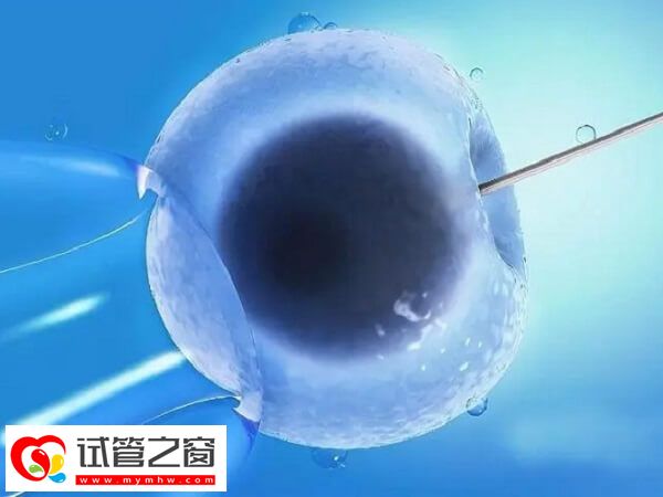 試管嬰兒可不可以避免遺傳白化病(圖1) 三代試管嬰兒能避免遺傳疾病