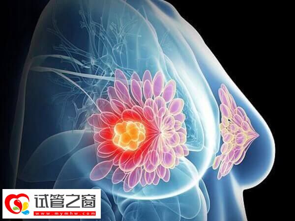 懷孕后乳房變軟是正常生理現象