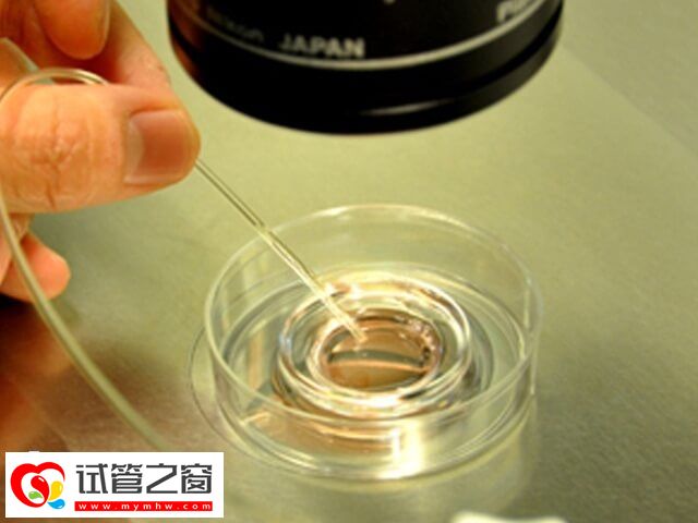 國(guó)內(nèi)供精試管要多少錢(圖2) 供精和卵試管流程相差不大