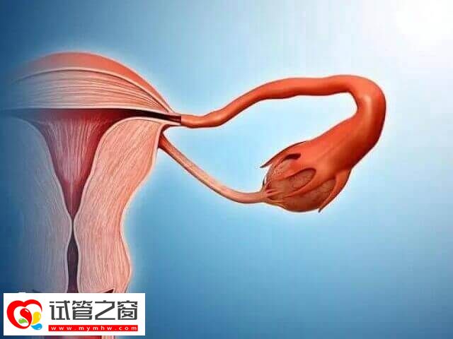 大的卵巢囊腫要先進行治療