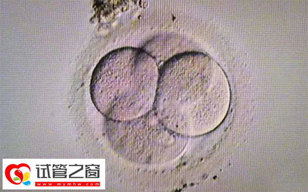 試管嬰兒三代篩查過程是怎樣的(圖1) 胚胎PGD篩查一般不需要抽血