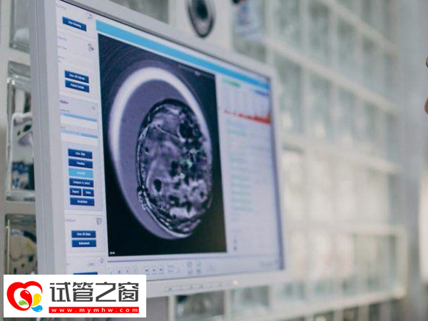試管嬰兒三代篩查過程是怎樣的(圖3) 三代試管能阻斷單基因遺傳病