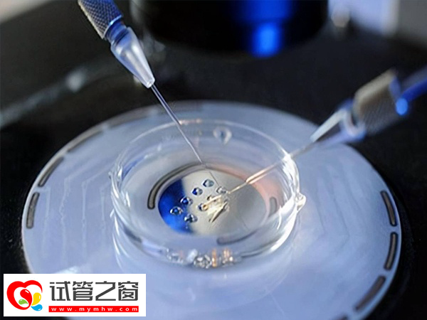 三代試管pgs篩查是什么意思(圖1) pgs篩查從技術上看可以選看性別