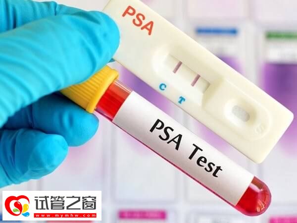 試管拮抗劑方案適合什么人群(圖1) 高齡女性促排身體負(fù)擔(dān)大