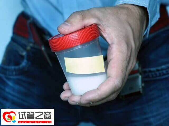 試管嬰兒怎么取精子(圖1) 做試管嬰兒要先取精子