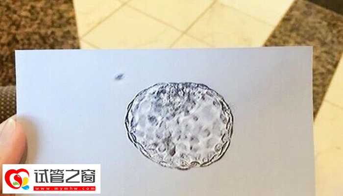 女性在解凍胚胎前要檢查身體