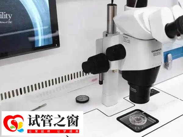 試管移植失敗先查明原因