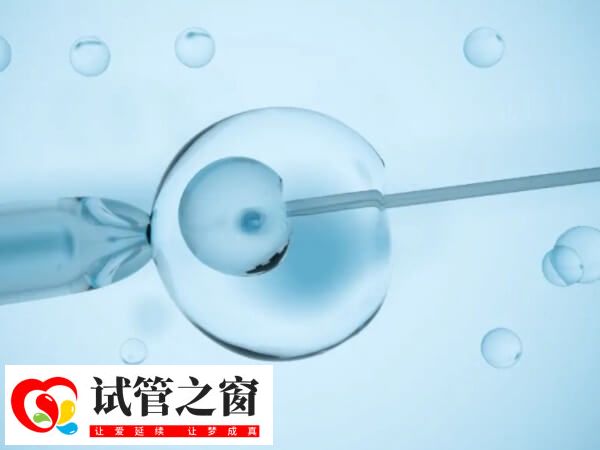 睪丸穿刺取精成功率約65%