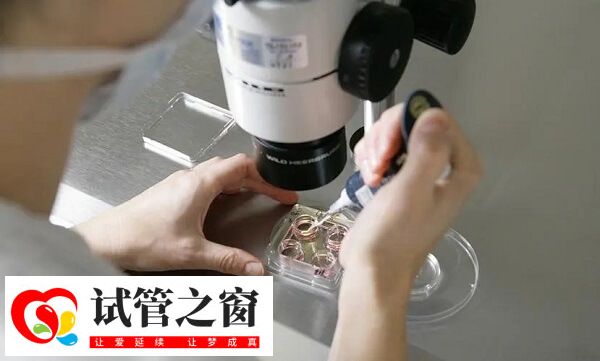 試管降調方案適合高齡女性