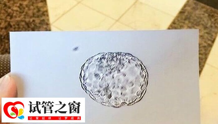 胚胎移植后出現(xiàn)宮縮是一種常見(jiàn)的現(xiàn)象,這可能是移植手術(shù)操作刺激宮腔所致,也可能是精神過(guò)于緊張導(dǎo)致宮縮,這都屬于正常現(xiàn)象,并不意味是移植失敗了。此外,胚胎移植后宮縮伴有少量出血,可能是胚胎植入內(nèi)膜所致,也可能是異位妊娠或是生化,具體還要以實(shí)際為準(zhǔn)。 試管移植后宮縮可能是著床了 胚胎移植后宮縮的原因 多數(shù)患者在進(jìn)行胚胎移植的時(shí)候,感覺(jué)會(huì)格外緊張和期待,緊張是擔(dān)心會(huì)移植失敗,期待是希望可以一次成功。由(圖2) 做試管嬰兒必須要有可用胚胎