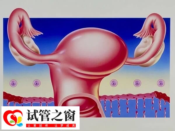 取卵后發生卵巢過激怎么辦(圖1) 卵巢過激是試管嬰兒常見的并發癥