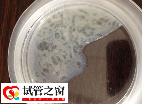 試管嬰兒精子的活力分為幾個等級(圖1) 精子活力三級是精子直線前進