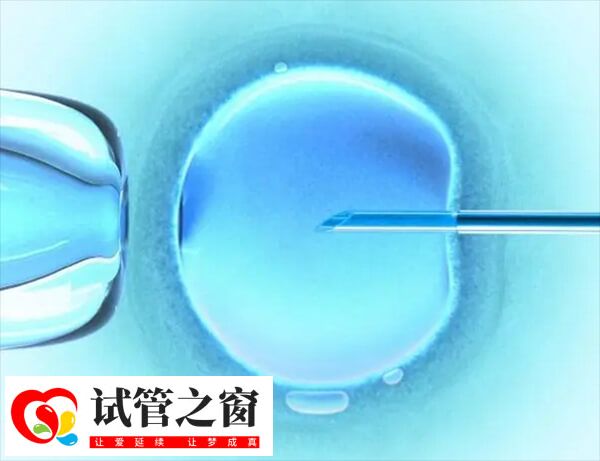 單精子注射是一種顯微操作技術