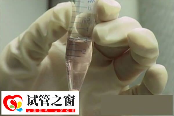 人工授精自然周期無需促排卵治療