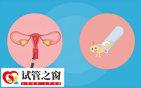 人工授精自然周期流程并不復雜