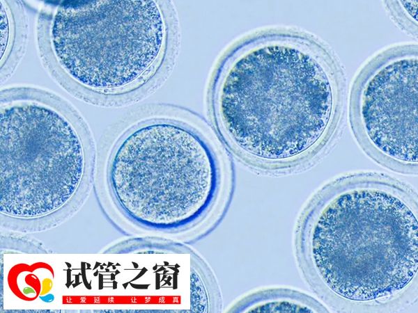 攢胚胎的目的是為了提高成功率