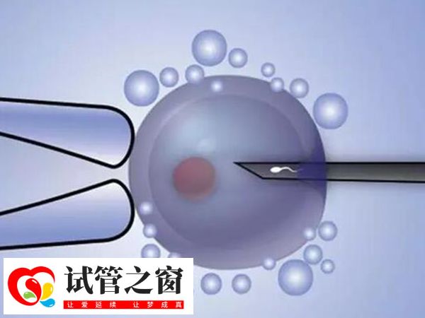 夫妻做三代試管能提高妊娠成功