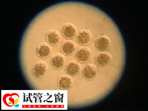 胚胎的等級評估主要依據胚胎的發育階段