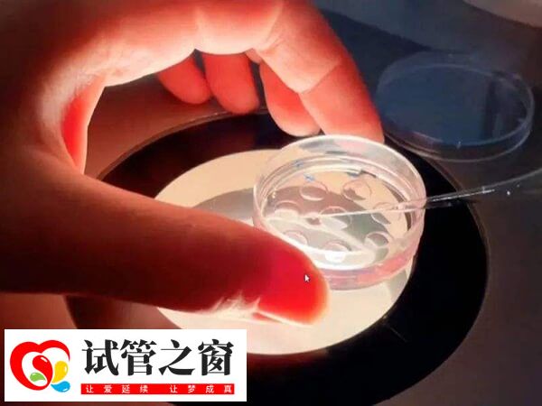 4ca囊胚質量怎么樣(圖2) 移植4ca囊胚并不會降低成功率