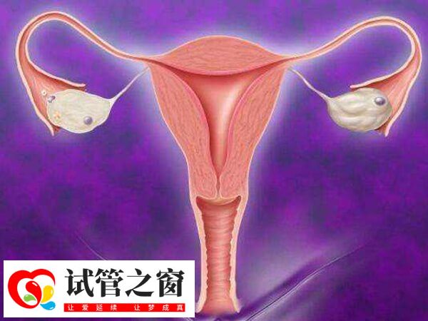 凍胚移植后肚子疼怎么辦(圖2) 試管移植后子宮收縮會引起肚子痛