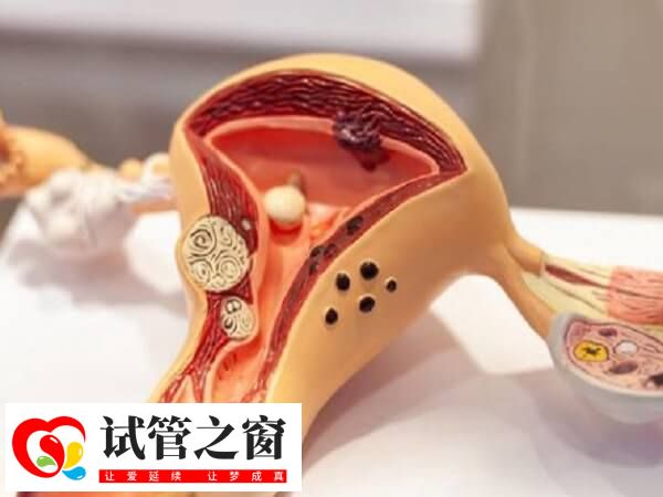 凍胚移植后肚子疼怎么辦(圖1) 試管嬰兒移植后肚子疼是常見的反應(yīng)