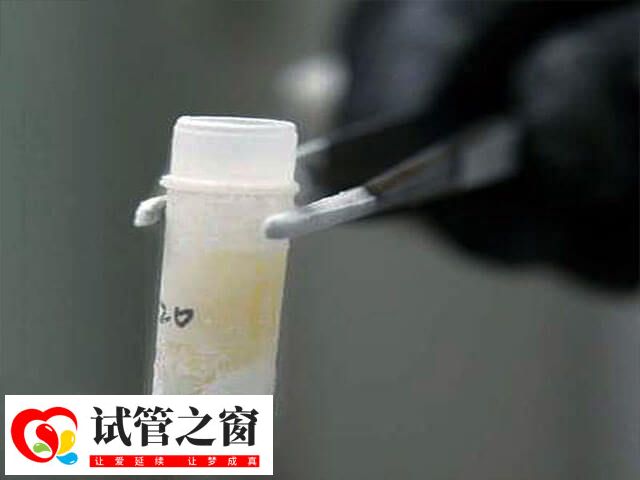 取精是在取精室通過手淫取精