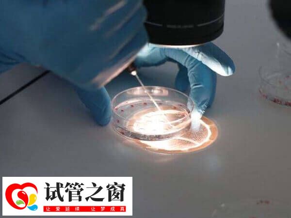 試管嬰兒胚胎養囊費多少錢(圖2) 養囊的具體的費用會根據醫院收費標準而異