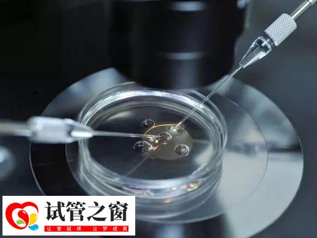 試管移植是一種輔助生育技術