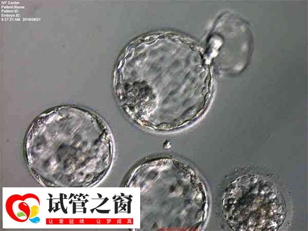 4cb囊胚的4表示在第4階段的囊胚