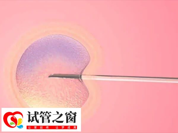 試管移植之后體內激素水平會出現變化