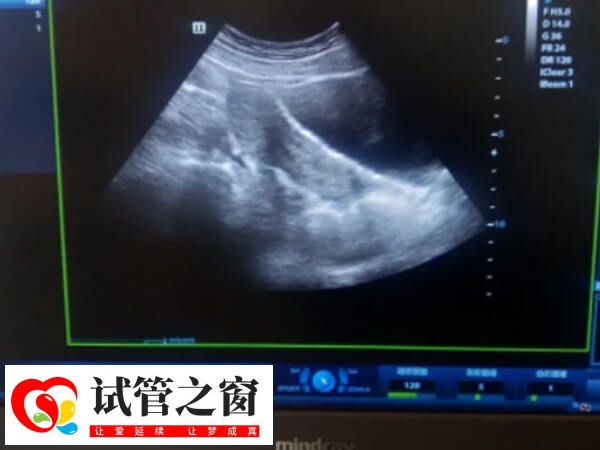 內膜形態異常一般不建議移植鮮胚