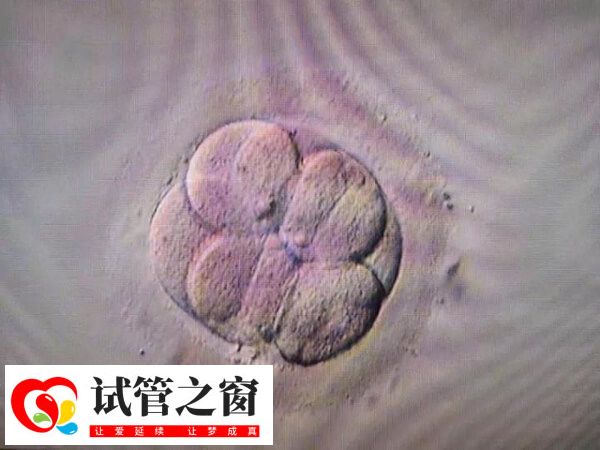 唐都醫院二次移植費用多少取決于是否有凍胚