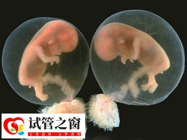 生育龍鳳胎的幾率并不高