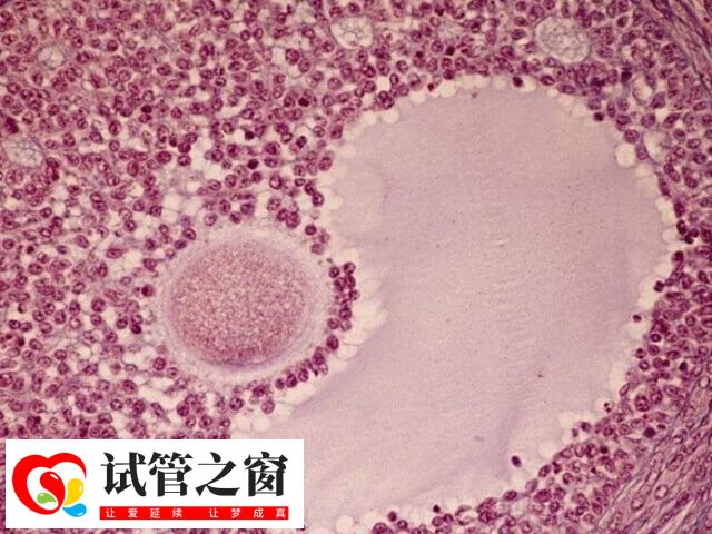 在南寧二醫(yī)院做試管嬰兒要提供結(jié)婚證和準(zhǔn)生證嗎?(圖1) 試管嬰兒也稱為體外受精-胚胎移植