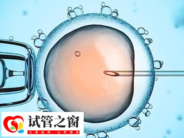 系統性紅斑狼瘡能做試管嬰兒