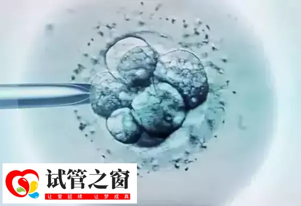 三代試管可排除掉攜帶疾病的胚胎