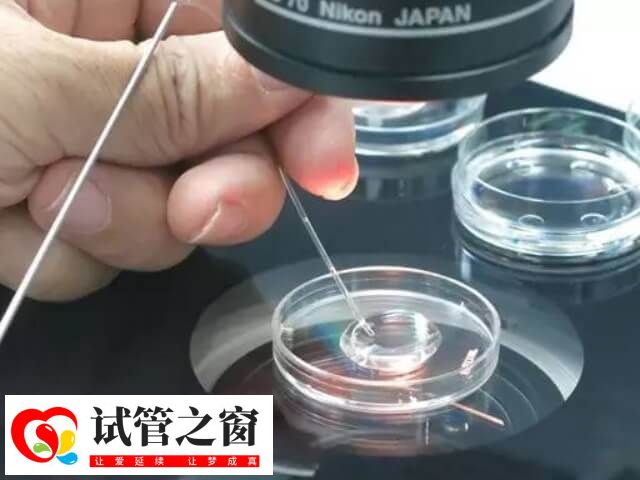 國內(nèi)做第三代試管的條件很嚴格