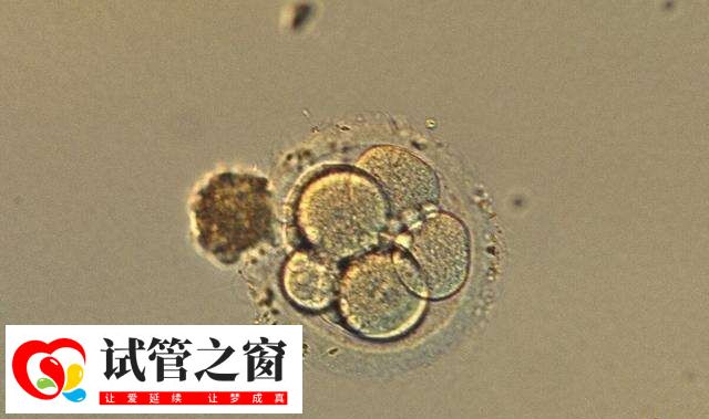 養囊全部成功說明什么(圖1) 囊胚更符合子宮生理狀態