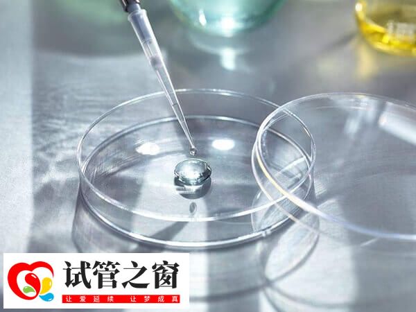 養(yǎng)囊成功移植是不是一定會成功(圖1) 養(yǎng)囊通常是指第三天的胚胎繼續(xù)體外培養(yǎng)