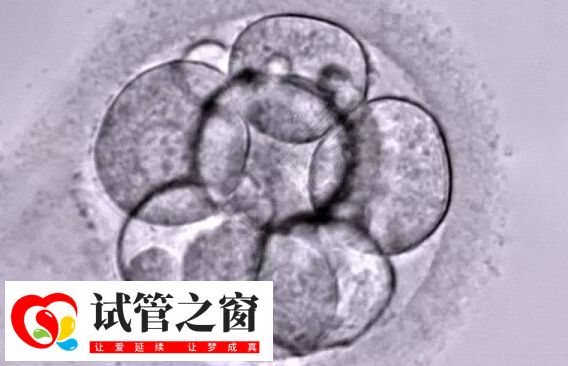 養囊從哪天開始算(圖1) 試管嬰兒需要在體外進行胚胎培養
