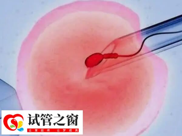 單腔取卵針只有一個細長的管道