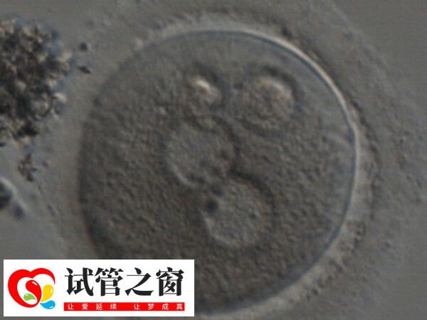 一代轉二代是基于現有卵子的補救措施