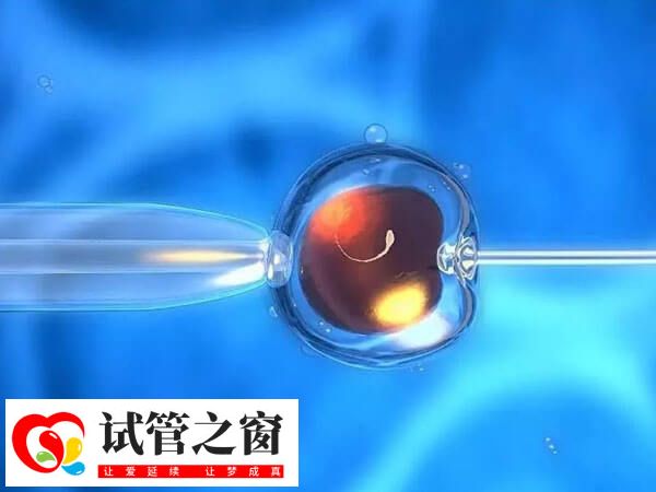 做試管嬰兒需要建檔