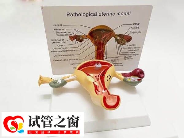 始基子宮是先天性發育不良