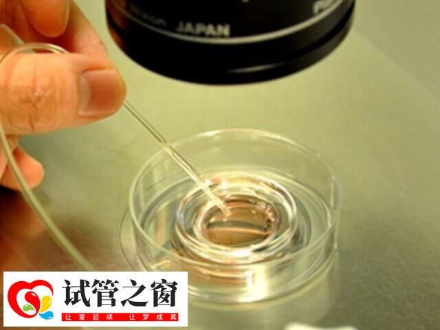 試管嬰兒取卵后培養(yǎng)多久才能進行胚胎移植?(圖1) 試管受精卵需培養(yǎng)3到5天成為胚胎